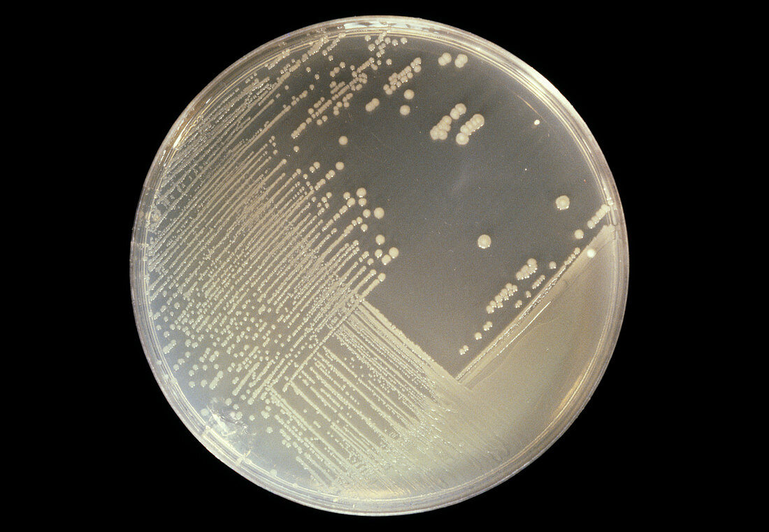 Cultured Shigella bacteria