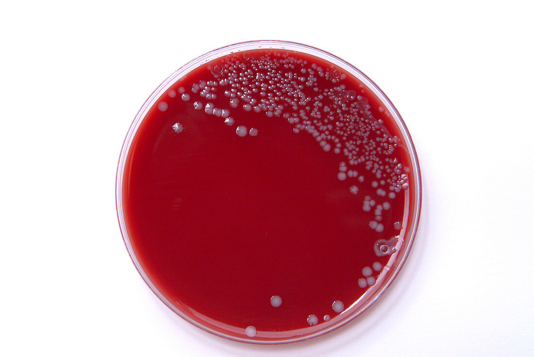 Listeria bacterial culture