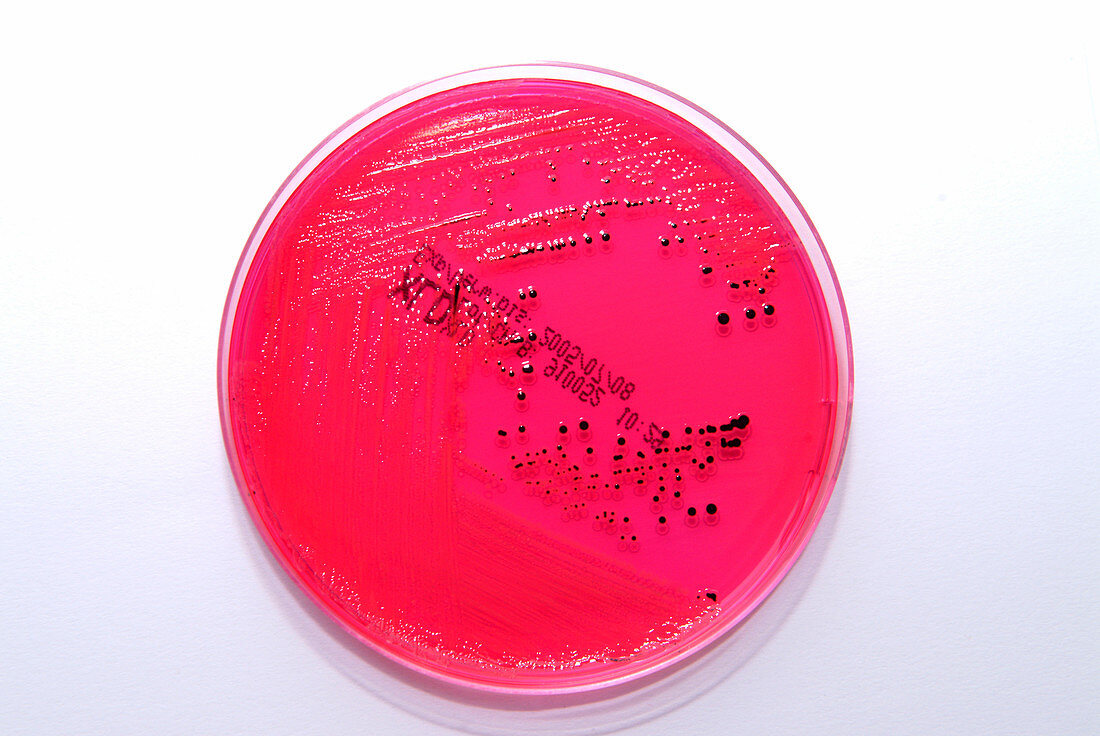 Salmonella bacterial culture