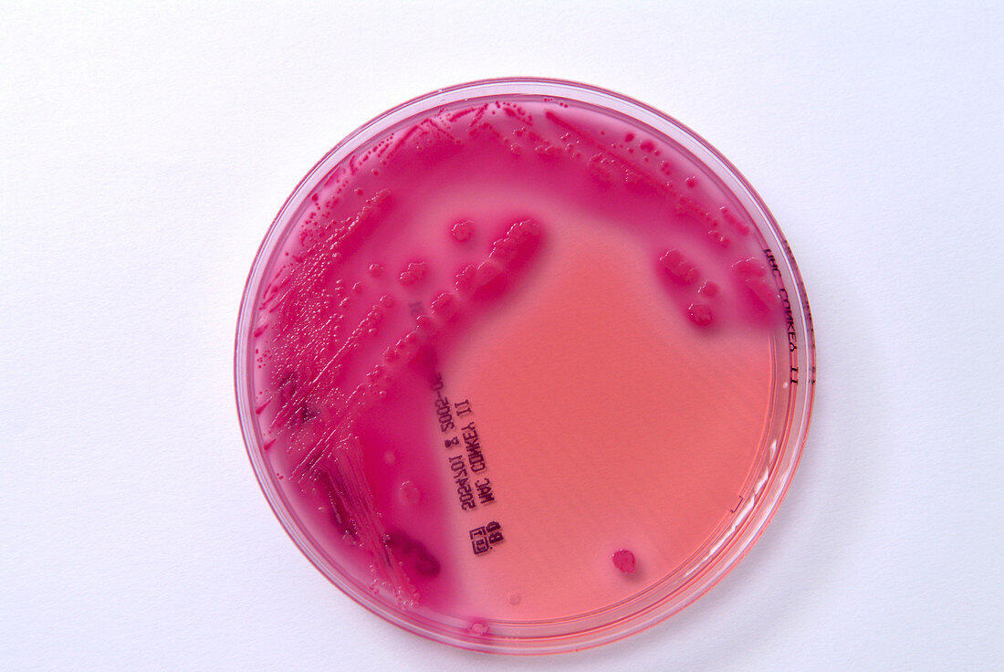 E. coli bacterial culture