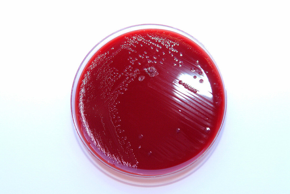 Gonococcal bacterial culture