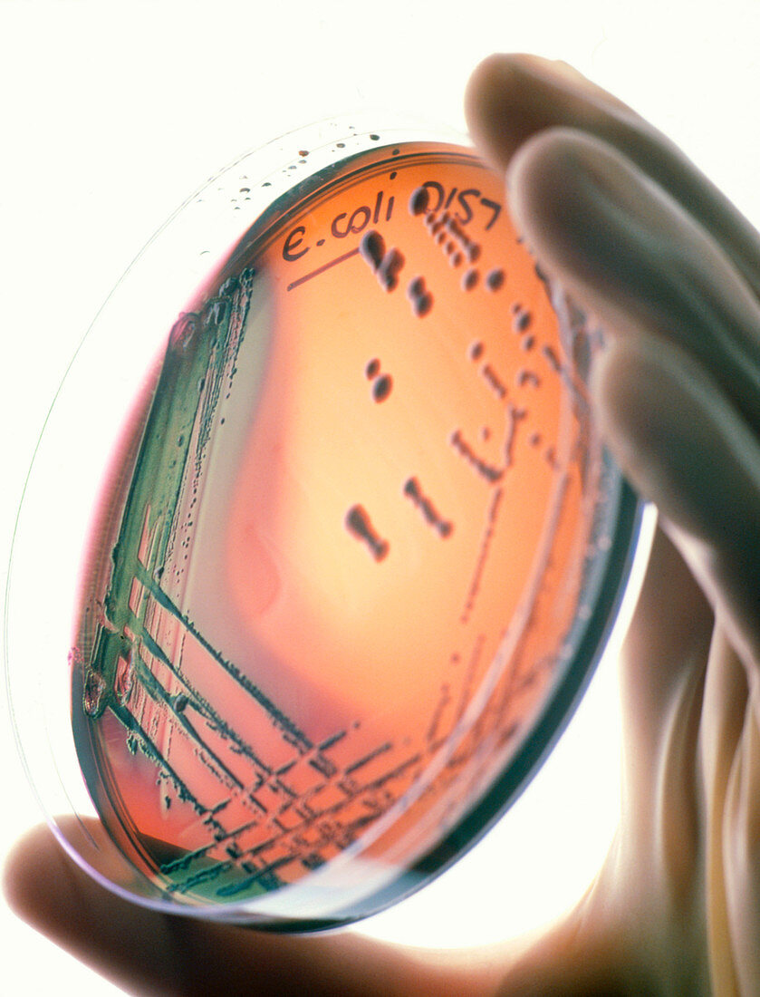 Petri-dish culture of Escherichia coli 0157:H7