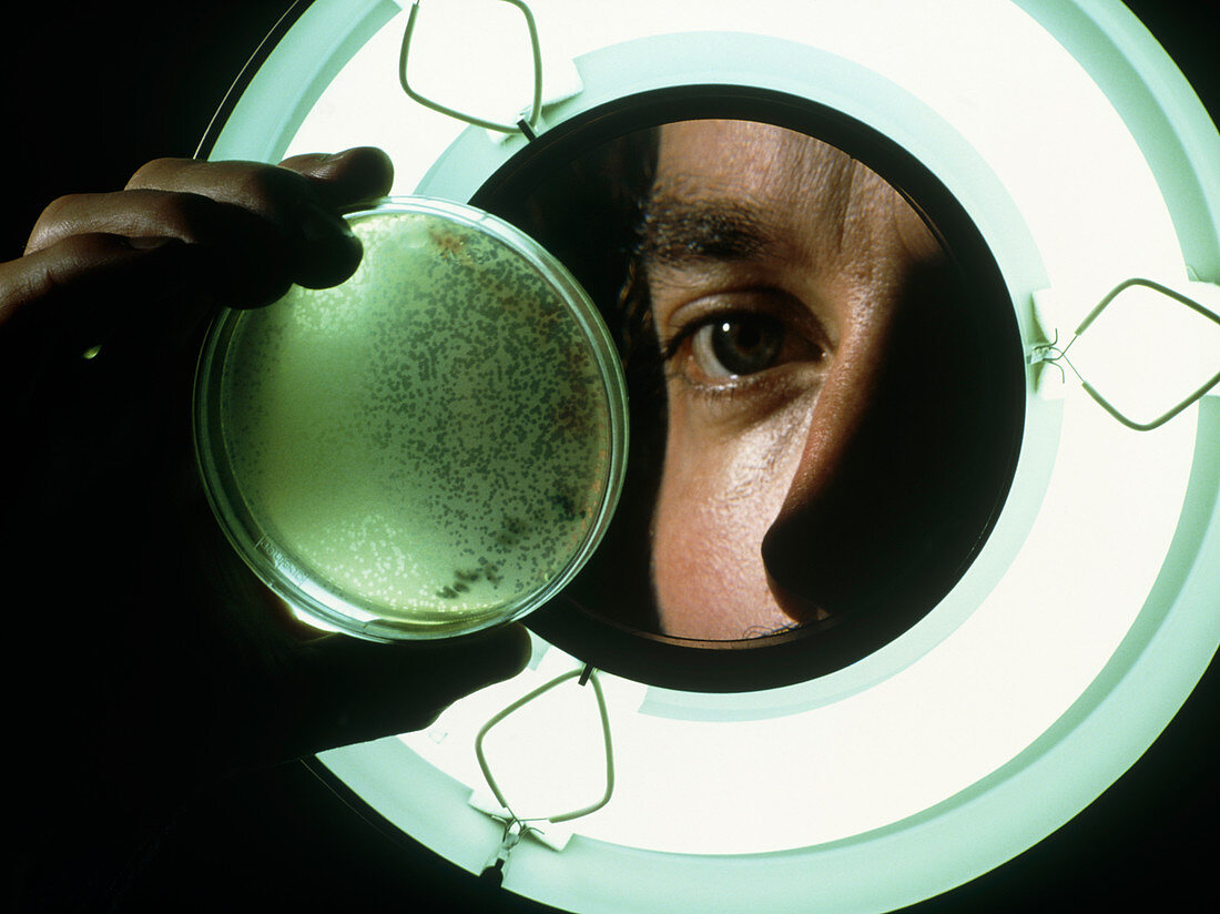 Researcher views bacteria culture with magnifier