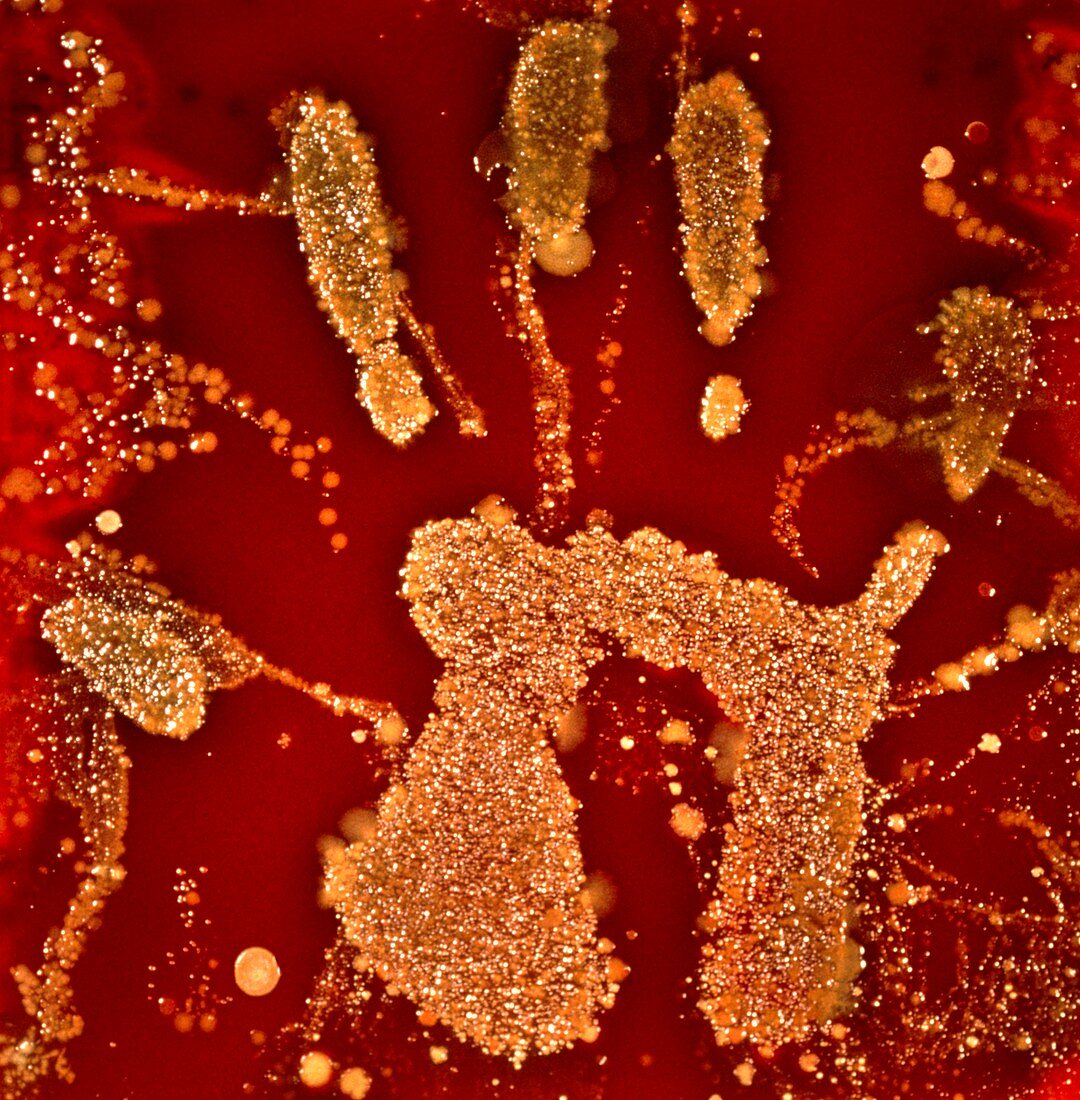 Bacteria on agar from hand print