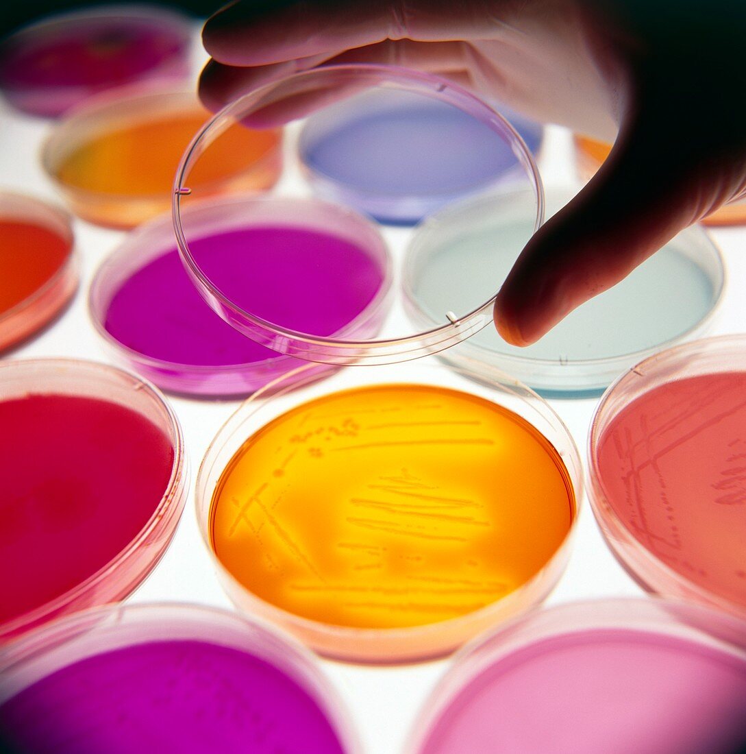 Hand puts lid on petri dish with bacterial culture