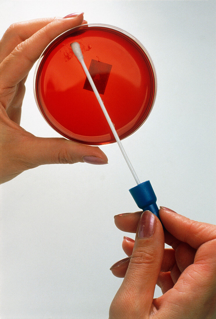 Hand wipes a vaginal swab onto gel in a petri dish