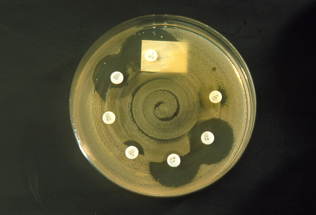 Petri dish bacterial antibiotic sensitivity