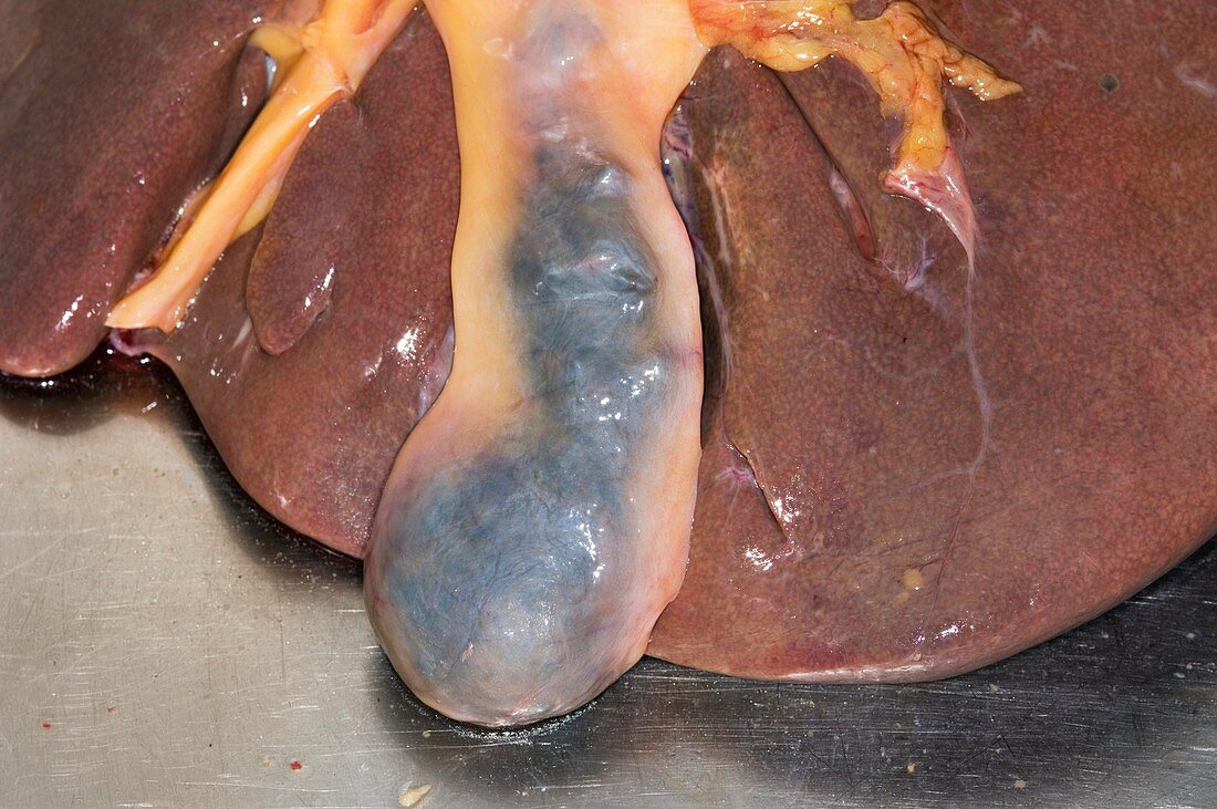 Liver and gallbladder,post-mortem