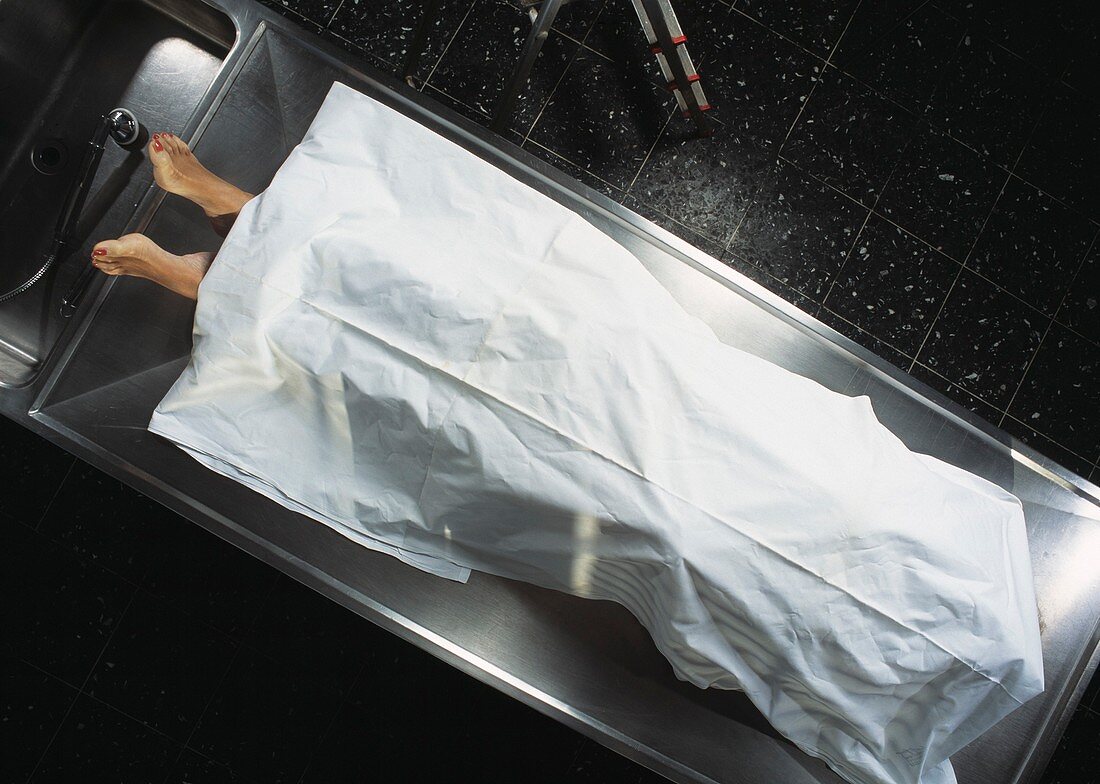 Dead body in a mortuary