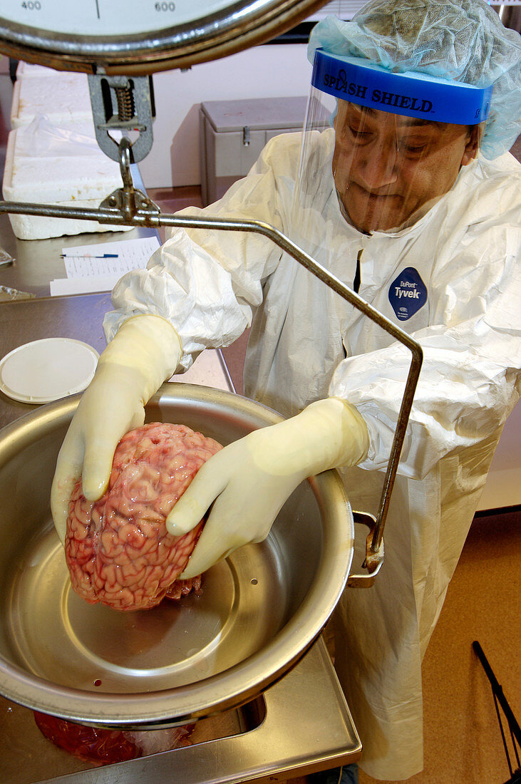 Technician weighs a human brain
