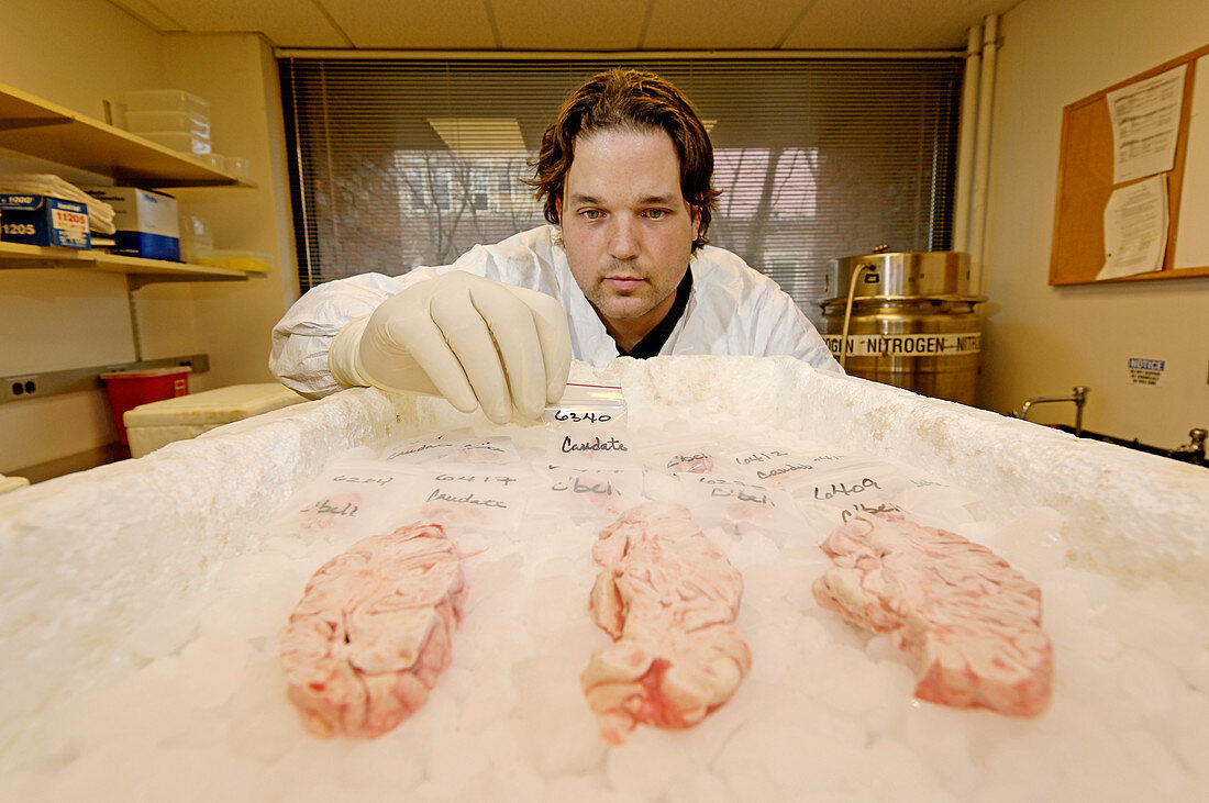 Technician examines human brain sections