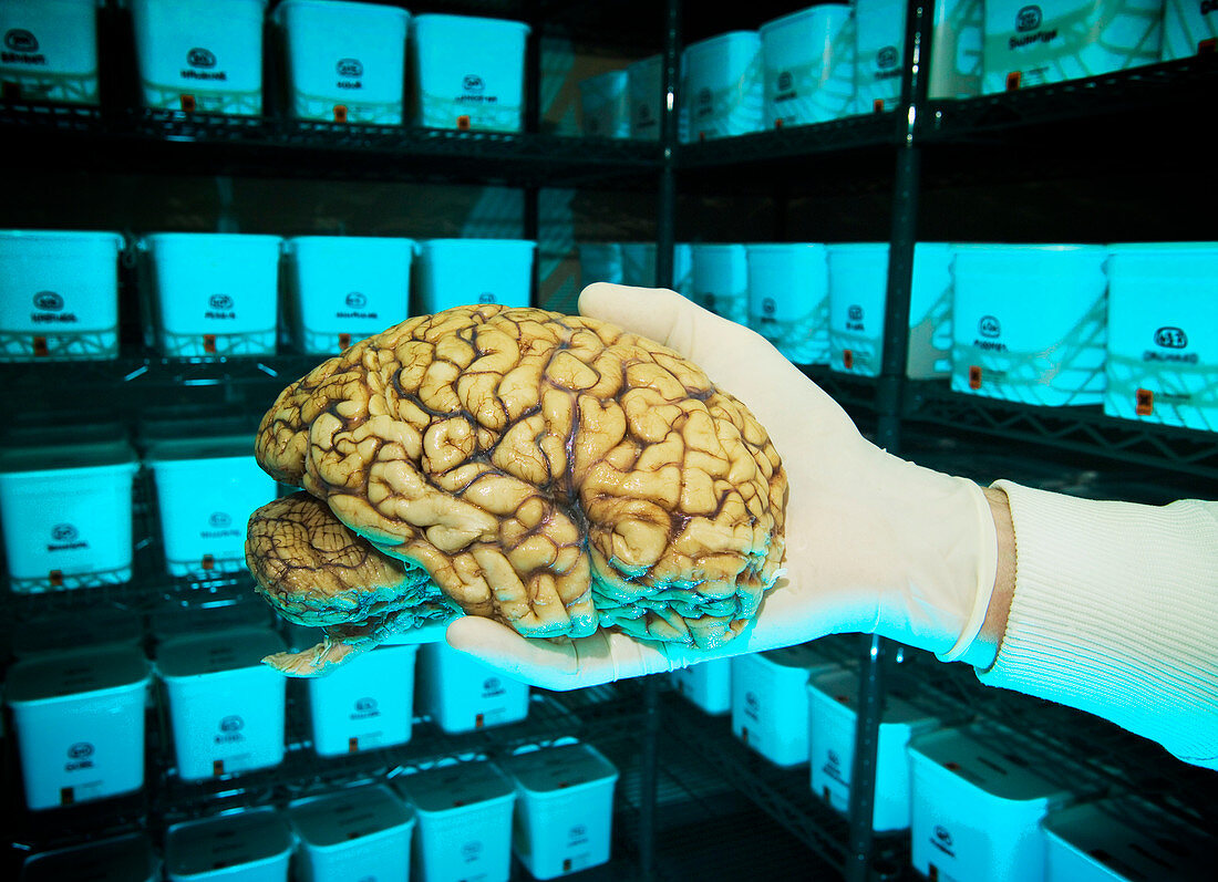 Human brain in brain bank
