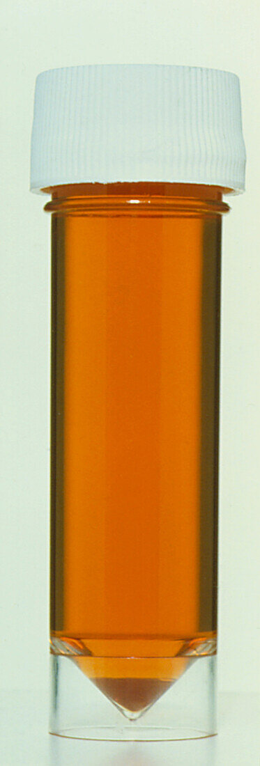 Sample tube containing a specimen of human urine