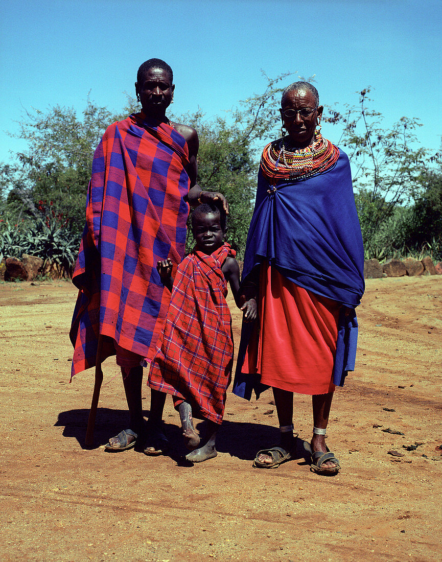 Burns patient,Kenya