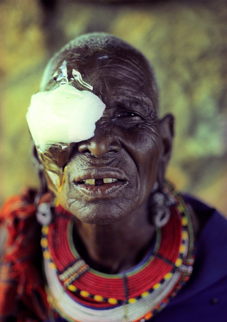 Eye surgery patient,Kenya