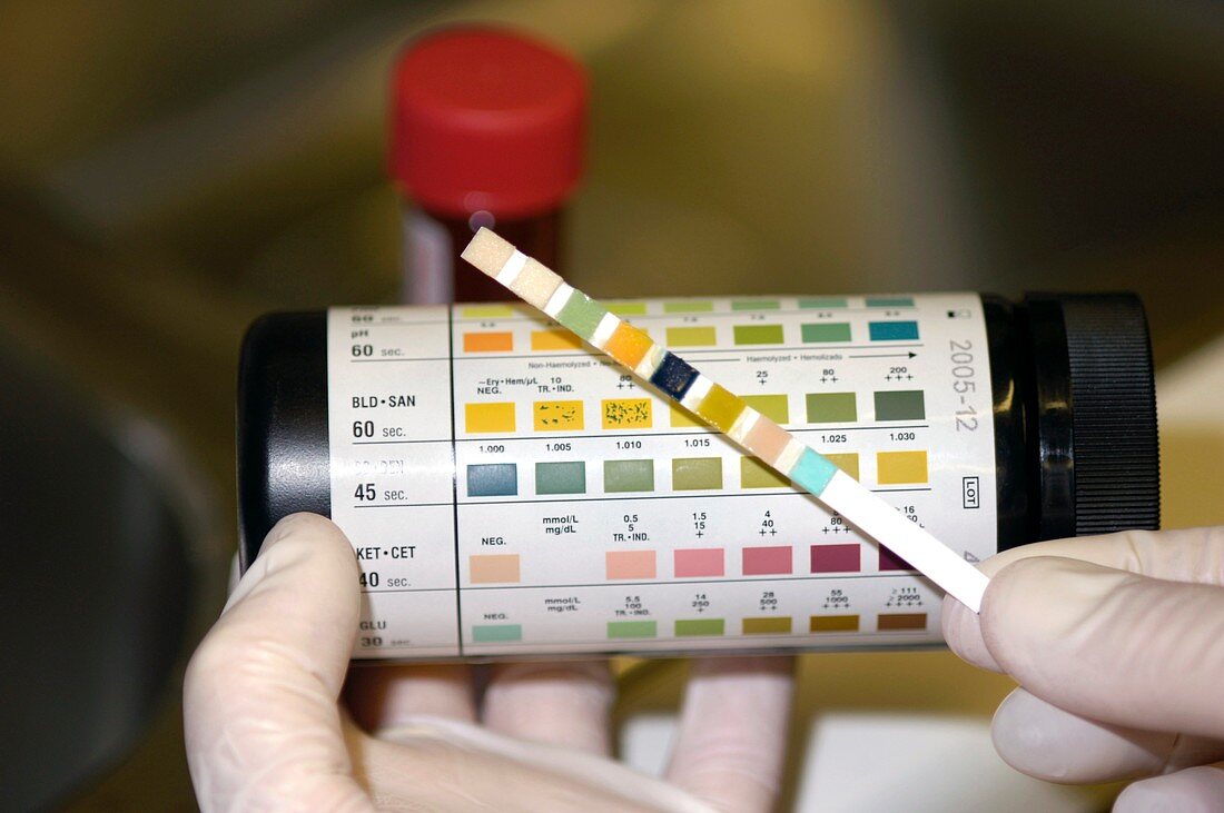 Testing for blood in a urine sample