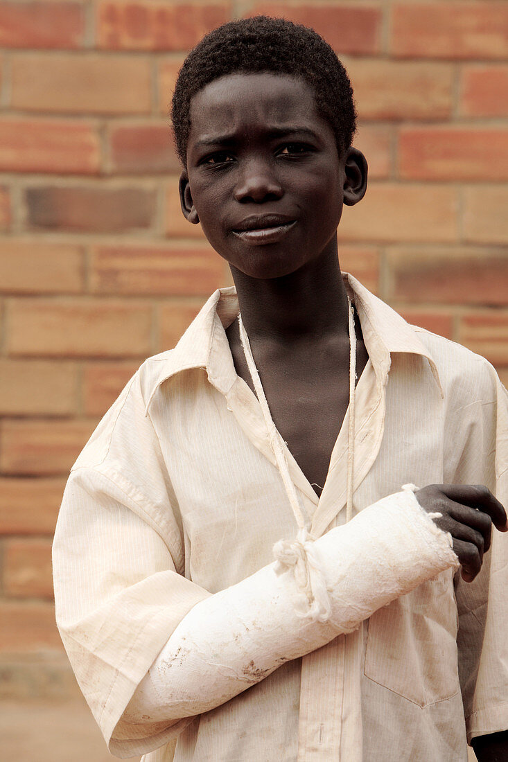 Boy with a broken arm