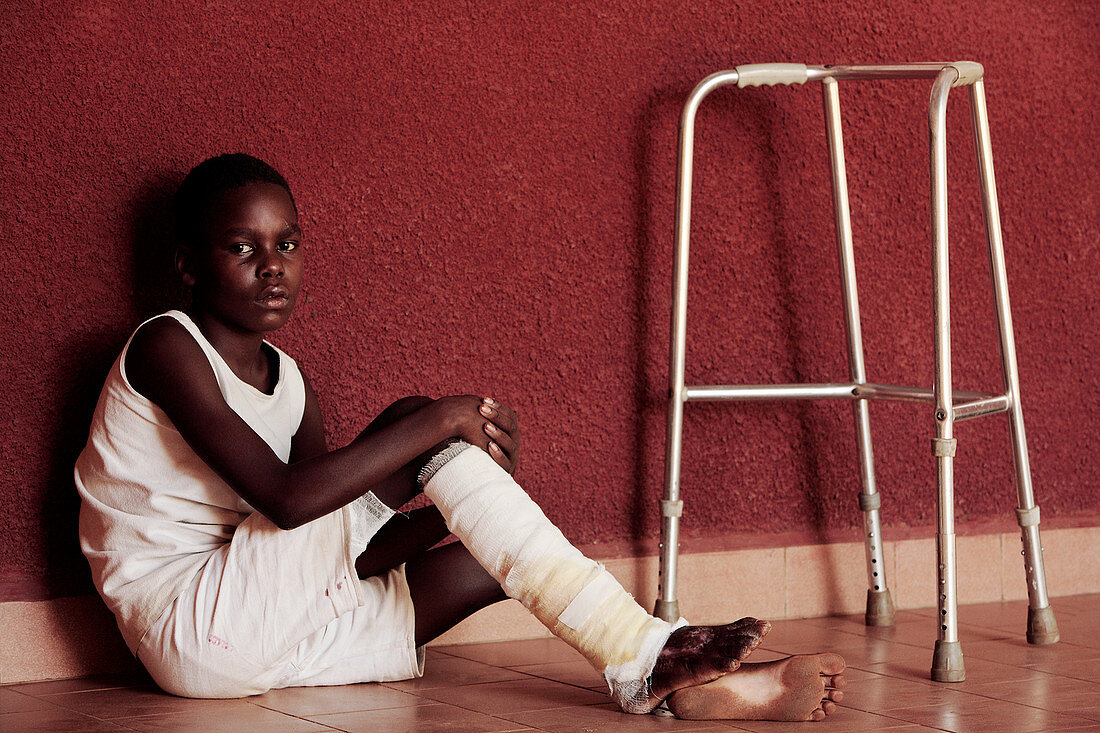 Girl with an injured leg