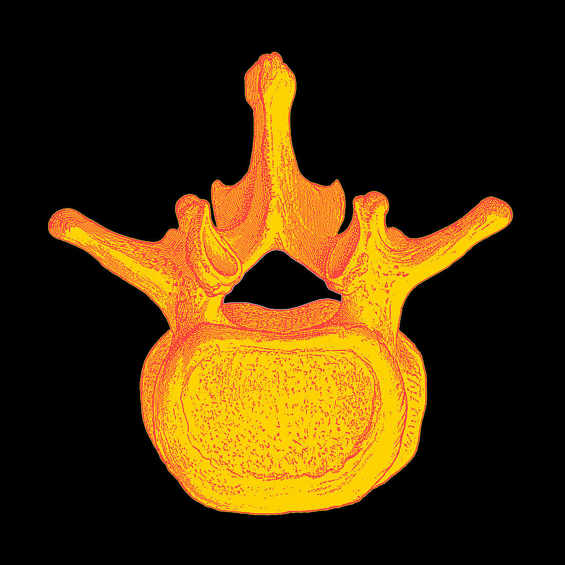 Spinal vertebra