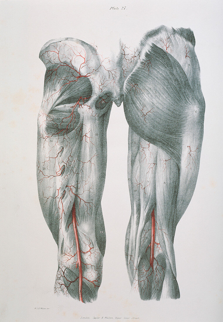 Upper leg arteries