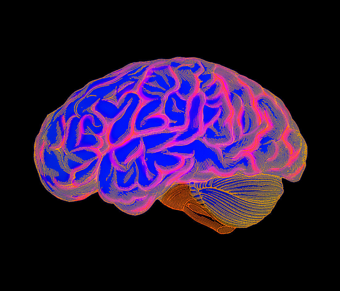 Human brain