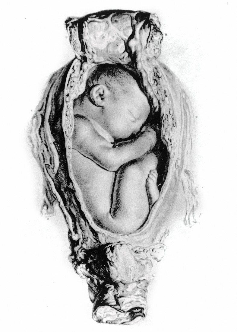 Foetus in uterus,drawing by W Hunter