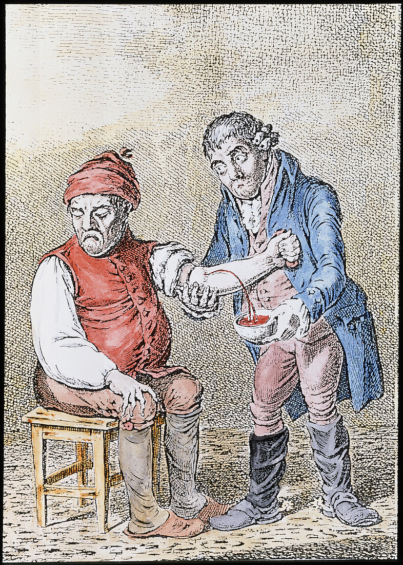 Artwork of a doctor bleeding a patient