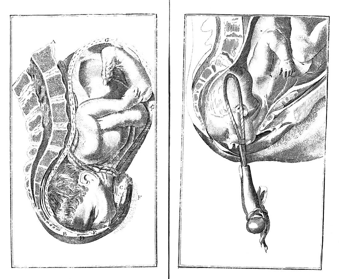 Childbirth illustrations