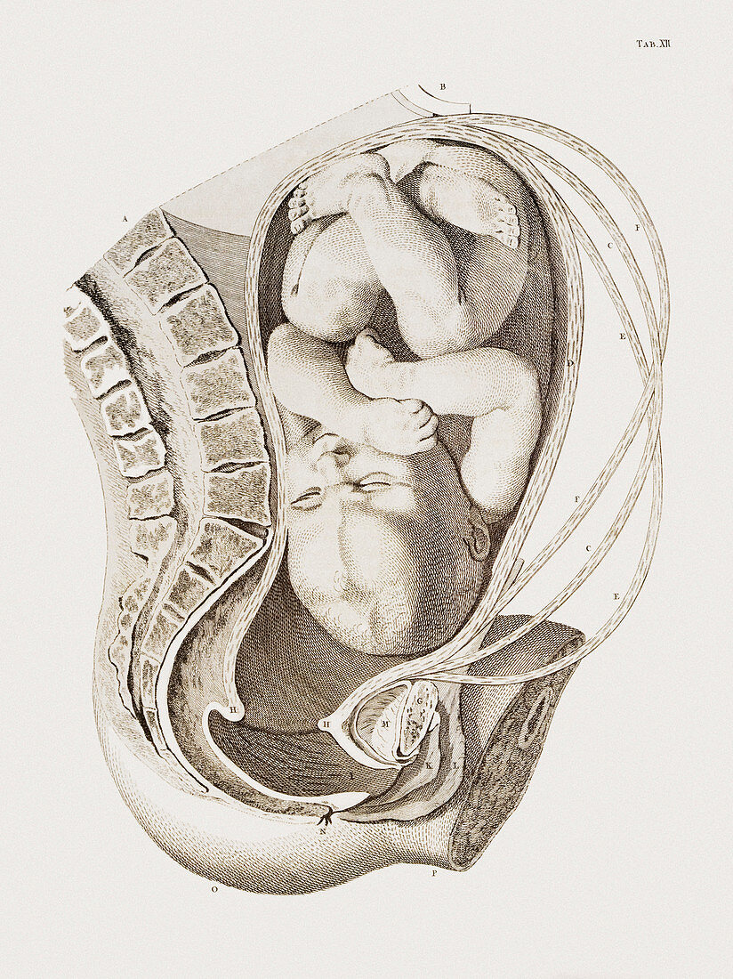 Foetus in the uterus during labour
