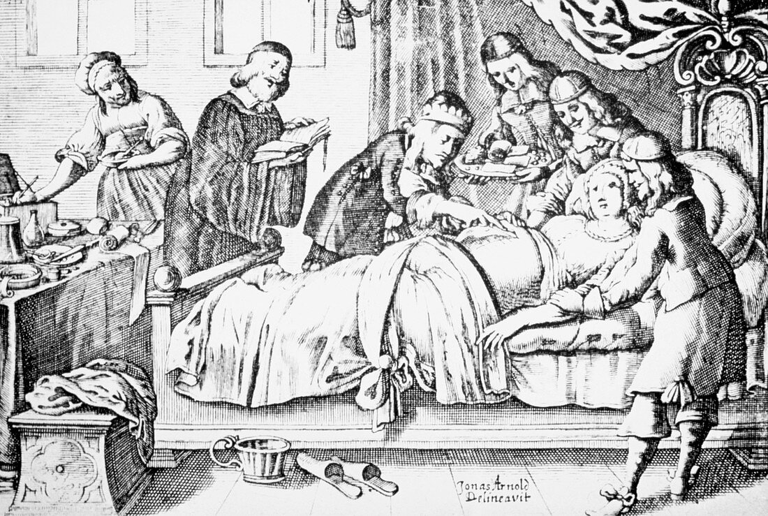 Engraving of a Medieval Caesarian section