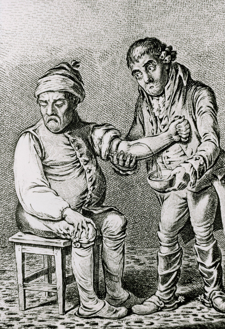 18th century print of a doctor bleeding a patient