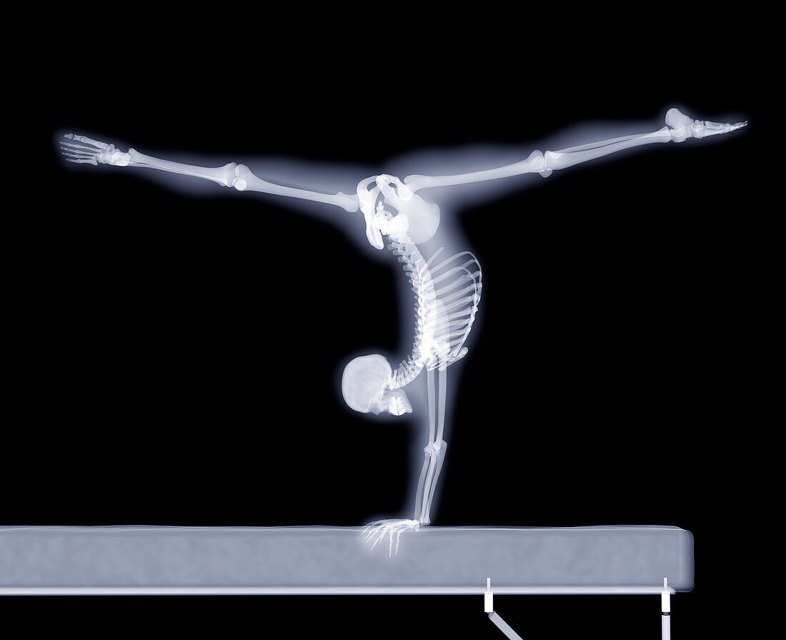 Gymnast on a beam,X-ray artwork