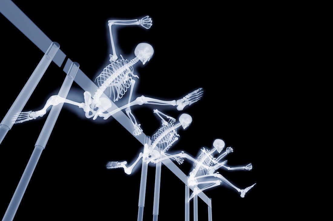 Three hurdlers hurdling,X-ray artwork