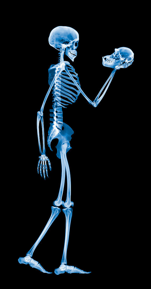 Skeleton holding a chimp skull,X-ray