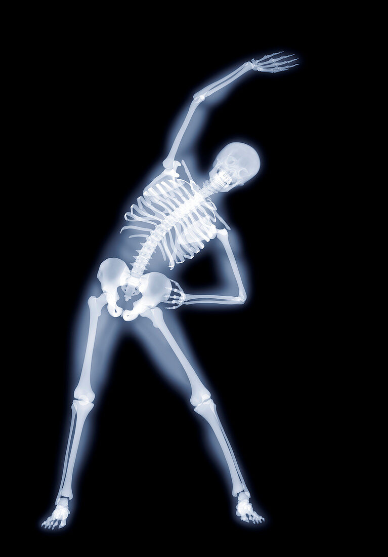 Side bend yoga position,X-ray artwork