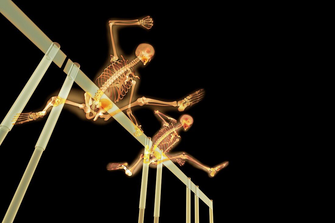 Hurdlers,X-ray artwork