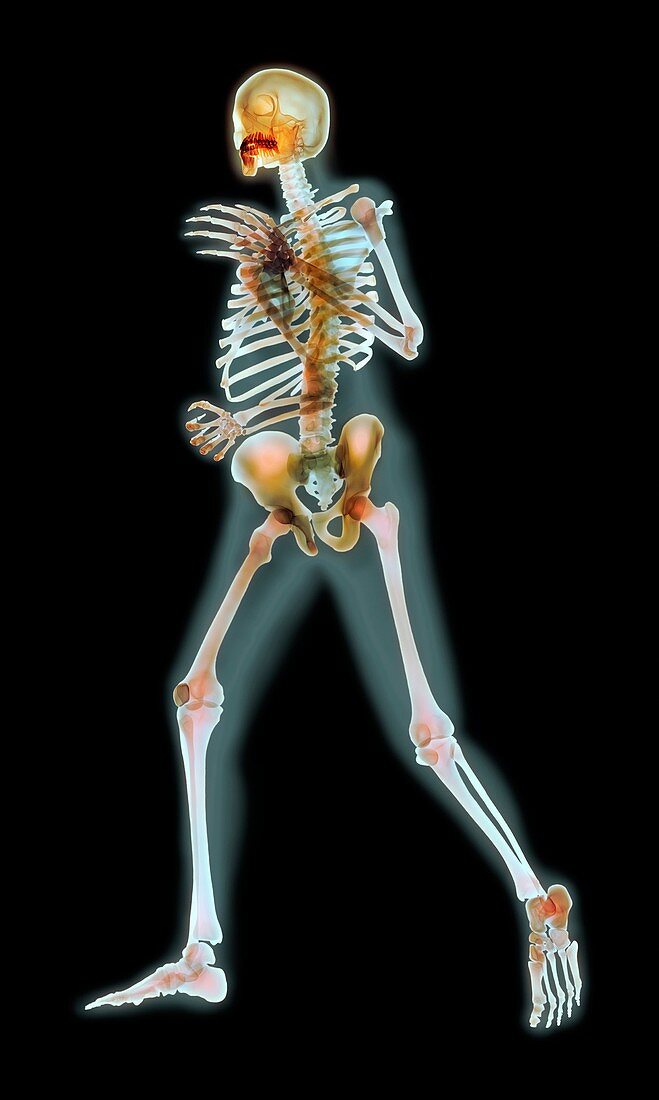 Runner,X-ray artwork