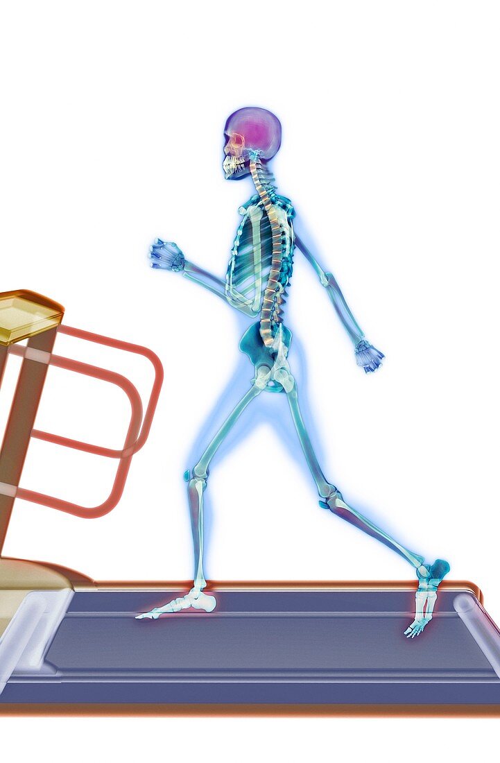 Fitness training,X-ray artwork