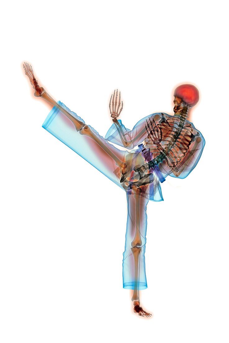 Martial arts kick,X-ray artwork