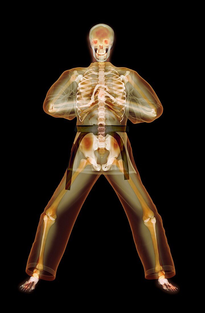 Martial arts greeting,X-ray artwork