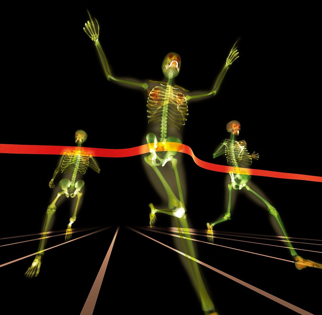 Athletes finishing a race,X-ray artwork