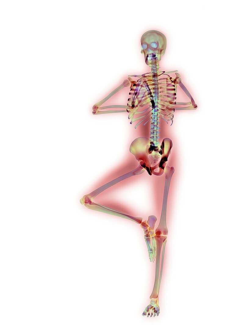 Yoga position,X-ray position