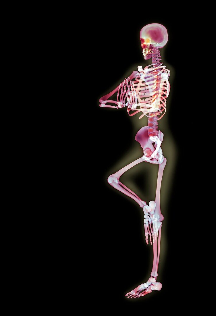 Yoga position,X-ray position