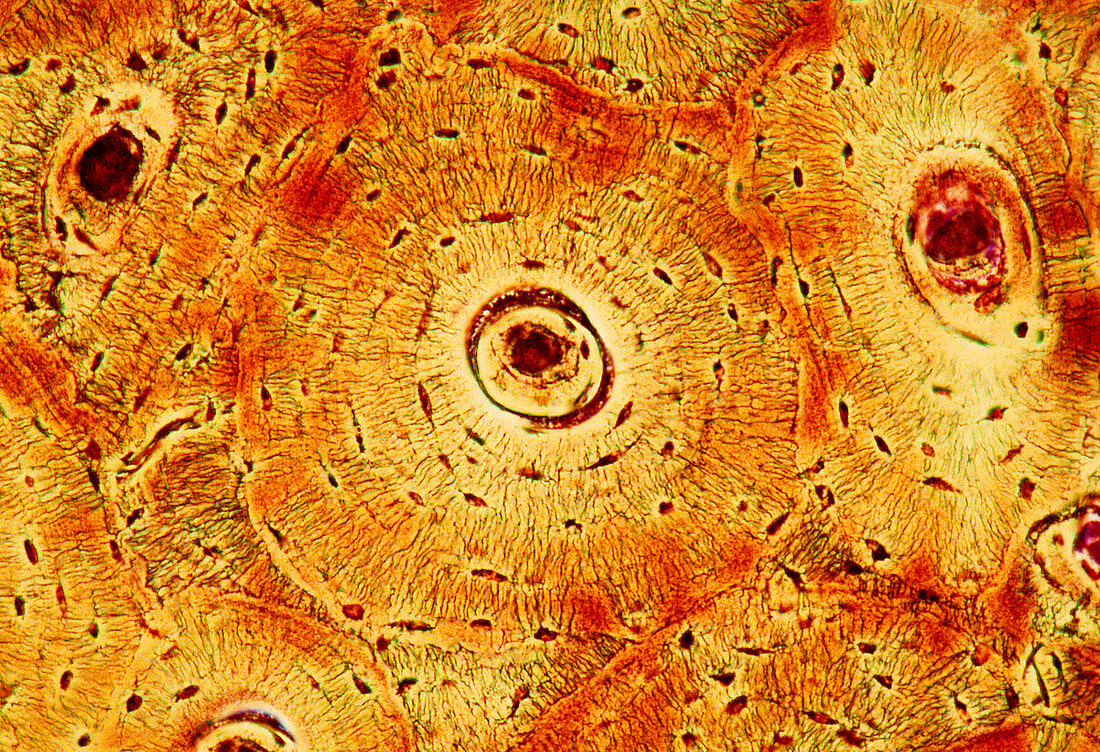 Bone canals,light micrograph