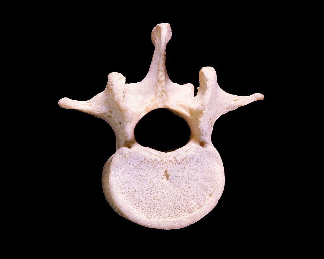 The third human lumbar vertebra L3