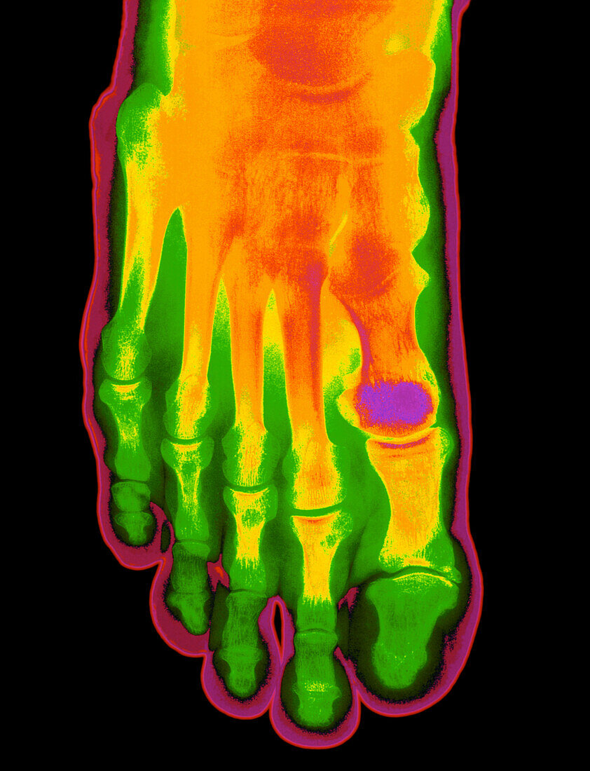 Coloured X-ray of a healthy foot (top view)