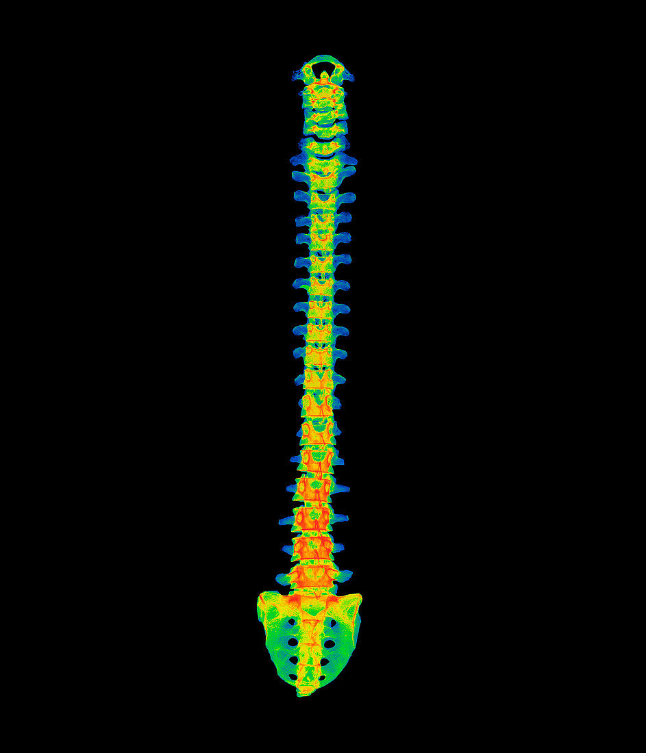 Coloured X-ray of a healthy human spine