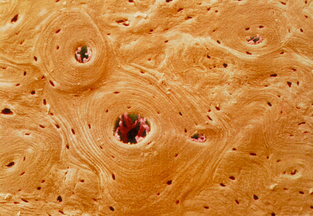 Coloured SEM of transverse section of compact bone