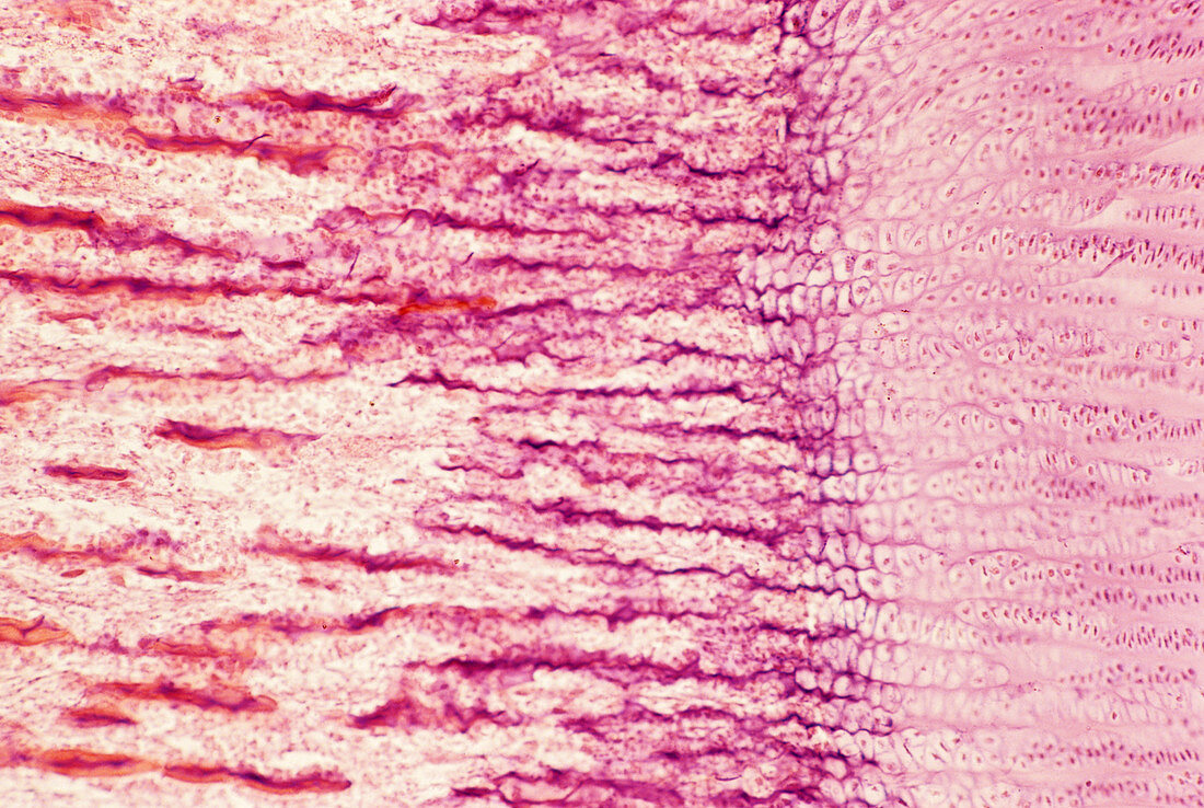 Bone growth,light micrograph
