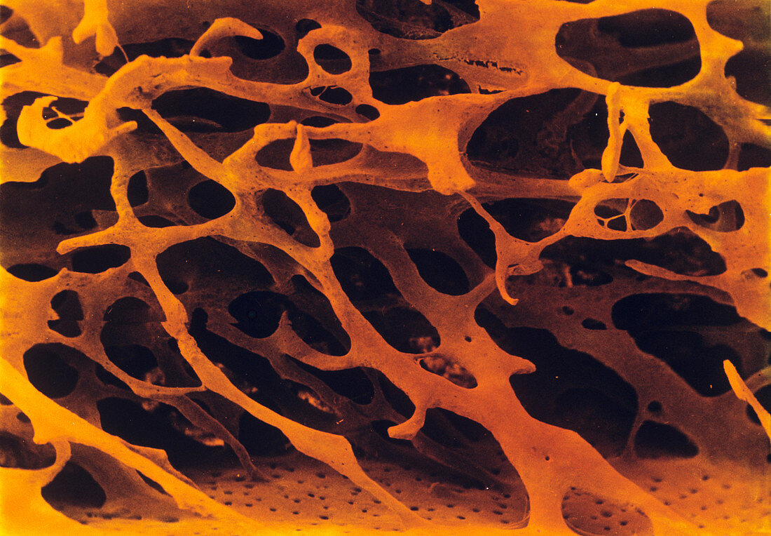 Spongy bone tissue,coloured SEM